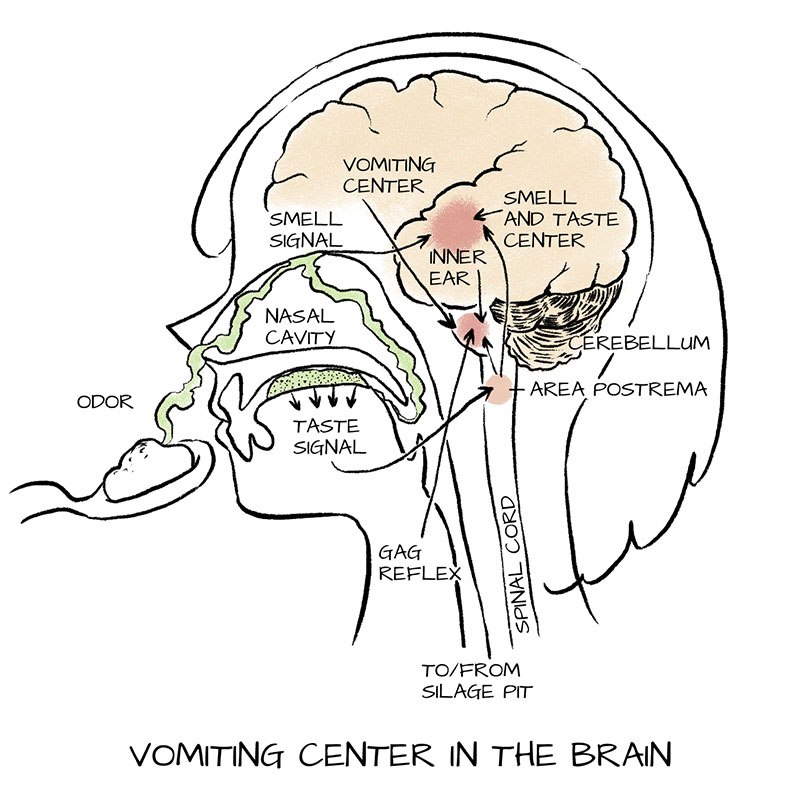 A diagram of how certain foods and smell trigger nausea in the vomiting center of the brain.
